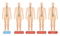 Spinal Curvature Infographic Set