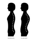 Spinal curvature Royalty Free Stock Photo