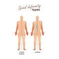 Spinal deformity types. Diseases of the spine.scoliosis and normal posture. Vector human silhouettes