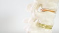 Spinal disc herniation as close-up as 3D Rendering Royalty Free Stock Photo