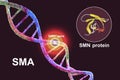 Spinal muscular atrophy, SMA, a genetic neuromuscular disorder with progressive muscle wasting