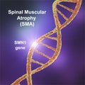 Spinal muscular atrophy, SMA, a genetic neuromuscular disorder Royalty Free Stock Photo