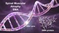 Spinal muscular atrophy, SMA, a genetic neuromuscular disorder with progressive muscle wasting