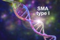 Spinal muscular atrophy, SMA, a genetic neuromuscular disorder Royalty Free Stock Photo