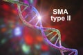 Spinal muscular atrophy, SMA, a genetic neuromuscular disorder Royalty Free Stock Photo