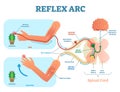 Spinal Reflex Arc anatomical scheme, vector illustration, with stimulus, sensory neuron, motor neuron and muscle tissue.