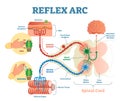 Spinal Reflex Arc anatomical scheme, vector illustration, with stimulus, sensory neuron, motor neuron and muscle tissue.