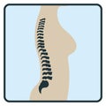 Spine backbone bone, x-ray concept icon, roentgen human body image isolated on white, flat vector illustration. Skeleton part of Royalty Free Stock Photo