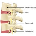 Spine disc and vertebral body anatomy medical vector illustration on white background