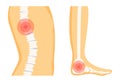Spine and Foot Trauma Set, Vector Illustration
