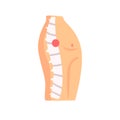 Spine injury pain cartoon vector Illustration o Royalty Free Stock Photo