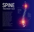 Spine injury treatment, xray human back, healthcare infographic, spinal pain vector illustration.