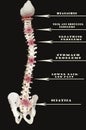 Spine Labeled by Areas Affected