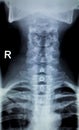 Spine neck Xray test scan Royalty Free Stock Photo