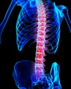 Spine painful skeleton x-ray, 3D illustration.