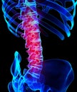 Spine painful skeleton x-ray, 3D illustration.