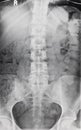 Spine and Pelvic X-ray