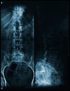 Spine and pelvis of a human body x-ray - front and lateral view Royalty Free Stock Photo