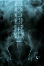 Spine and pelvis of a human body on x-ray image Royalty Free Stock Photo