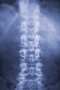 Spine on x-ray Royalty Free Stock Photo