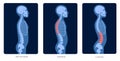 Spine X ray Royalty Free Stock Photo