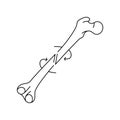 Spiral bone fracture line icon. Royalty Free Stock Photo