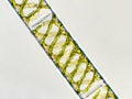 Spirogyra sp. algae under microscopic view, Chlorophyta