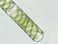 Spirogyra sp. algae under microscopic view x40 - Chlorophyta