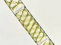 Spirogyra sp. Algae under microscopic view x40, Chlorophyta, green algae, blue green algae, background Royalty Free Stock Photo