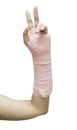 Splint,broken bone,broken hand isolate on white background