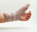 Splint finger a broken bone Royalty Free Stock Photo