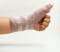 Splint finger a broken bone Royalty Free Stock Photo
