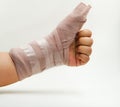 Splint finger a broken bone Royalty Free Stock Photo