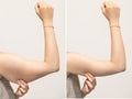 A split screen of a woman pinching the skin beneath her arm. Royalty Free Stock Photo