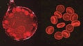 A splitscreen comparison of a healthy and sickleshaped red cell showcasing the drastic change in shape and structure. .