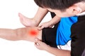 Sports injure. Asian child cyclist injured at thigh. Isolated on