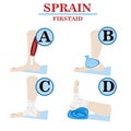 Sprain firstaid Royalty Free Stock Photo