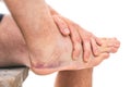 Sprained ankle with bruising Royalty Free Stock Photo