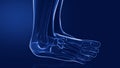 sprains and dislocations to the ankle Royalty Free Stock Photo