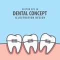 Square banner braces teeth illustration vector on blue backgrou