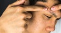 Squeeze acne, men suffer from pimples Royalty Free Stock Photo