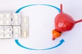 Stack of blisters with tablets or pill indicated by arrows in anatomic model of prostate gland and bladder. Concept photo of treat Royalty Free Stock Photo
