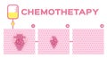 Stage of chemotherapy cure cancer cell