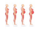 Stages of abdominal enlargement in pregnant woman. Anatomical skeletal structure female character