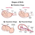 Stages of baby birth infographic diagram