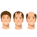 Stages of baldness.