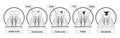 Stages Of Caries Infographic. Healthy Tooth, Enamel Caries, Dentin Caries, Pulpitis and Periodontitis Cross Section View