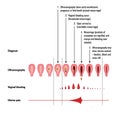 Stages and detection of miscarriage