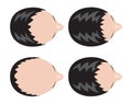 Stages of hair loss . bald man . no hair