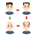 Stages of hair loss. Vector illustration